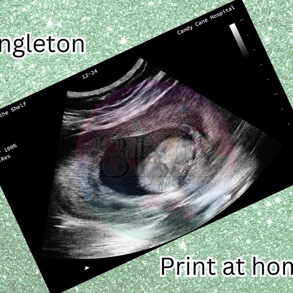 Elf Baby Ultrasound - Singleton - PNG Digital Download - Printable - HIGH Resolution - High Quality