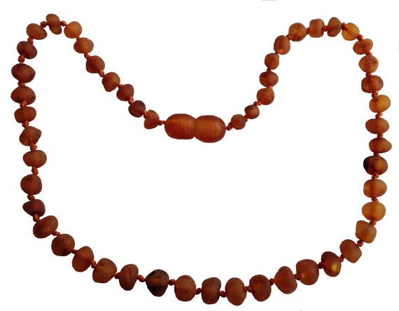 baltic amber pain relief