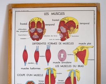 Anatomy - Human body - Life Sciences - Vintage - Large stunning French School Poster - double-sided - Kyphosis and scoliosis - Muscles