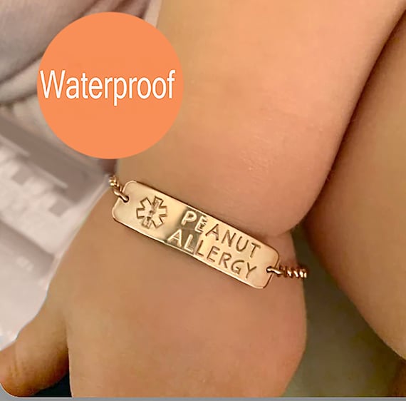 Allergy bracelets for babies best sale