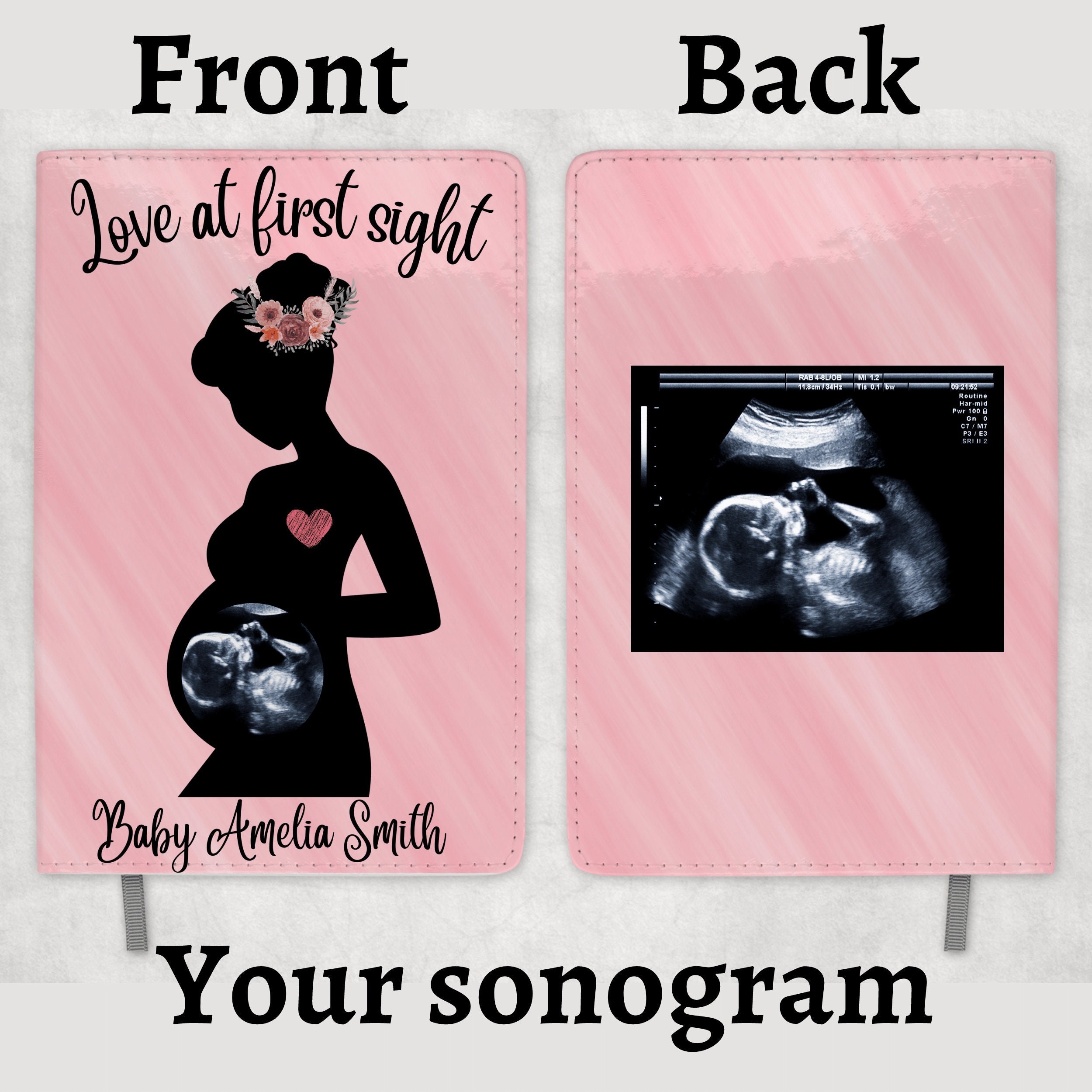 Tangerine Ultrasound Photo Album, Ultrasound Photo Album