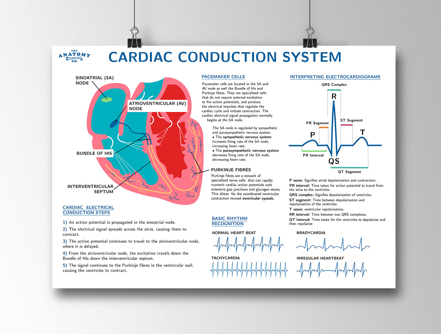 Cardiac Conduction System Anatomy Poster Etsy
