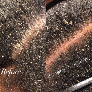 Puede incluir: Imagen de primer plano de un cuero cabelludo antes y despu&eacute;s de usar un spray para el cabello. La imagen anterior muestra un cuero cabelludo con caspa visible. La imagen posterior muestra el cuero cabelludo con caspa a&uacute;n presente. El texto "After spray hair still dirty" es visible en la imagen.