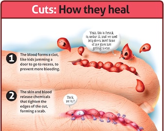 How a Cut Heals classroom poster .pdf file