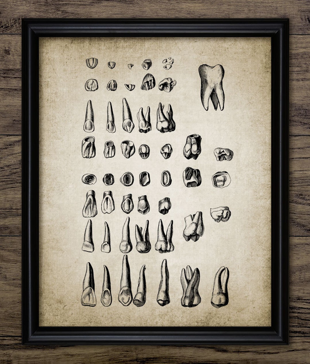 Human Teeth Wall Art, Printable Teeth, Dentist, Dental, Incisors ...