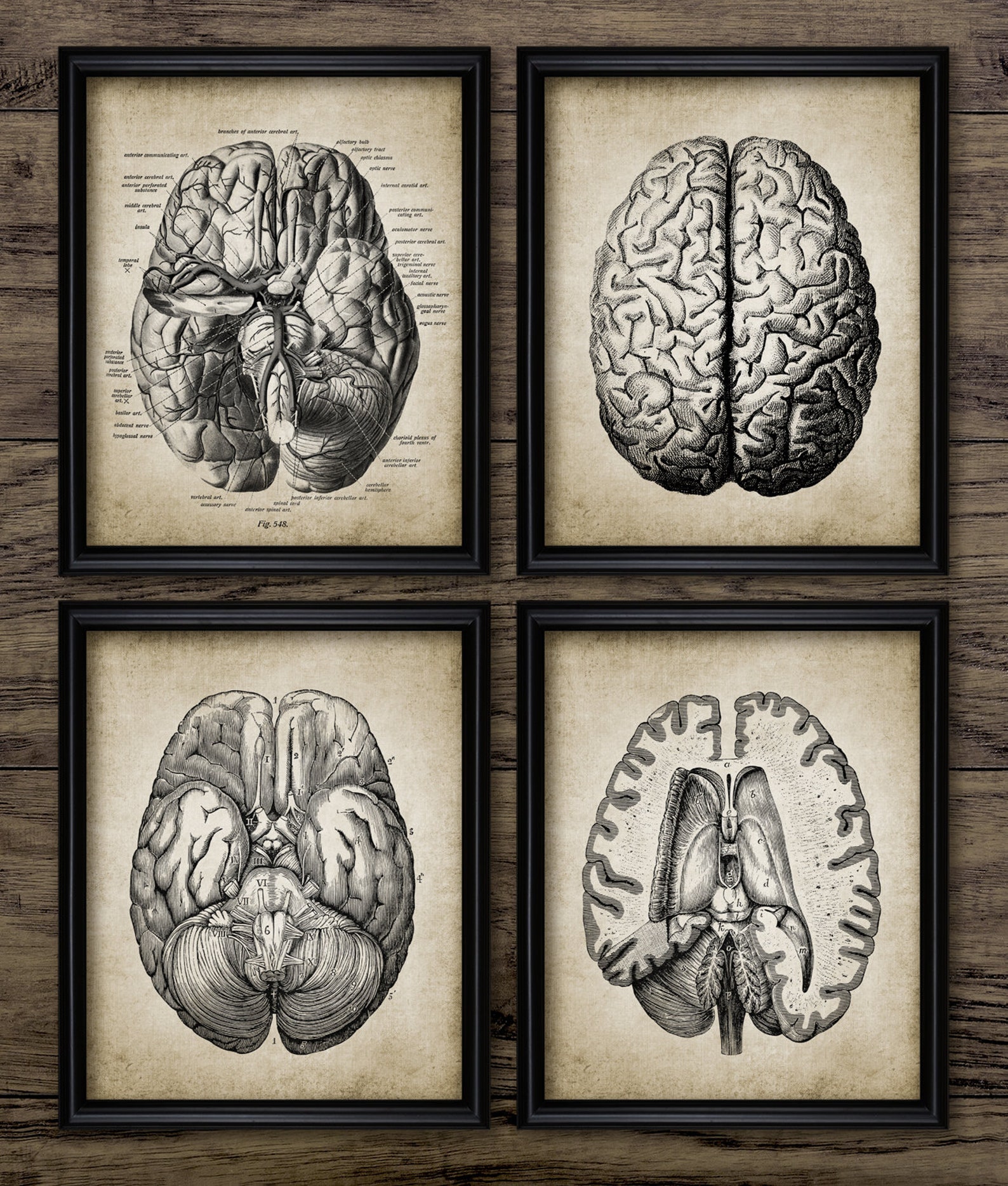 Brain Anatomy Set of 4 Human Brain Anatomy Neurology Art | Etsy