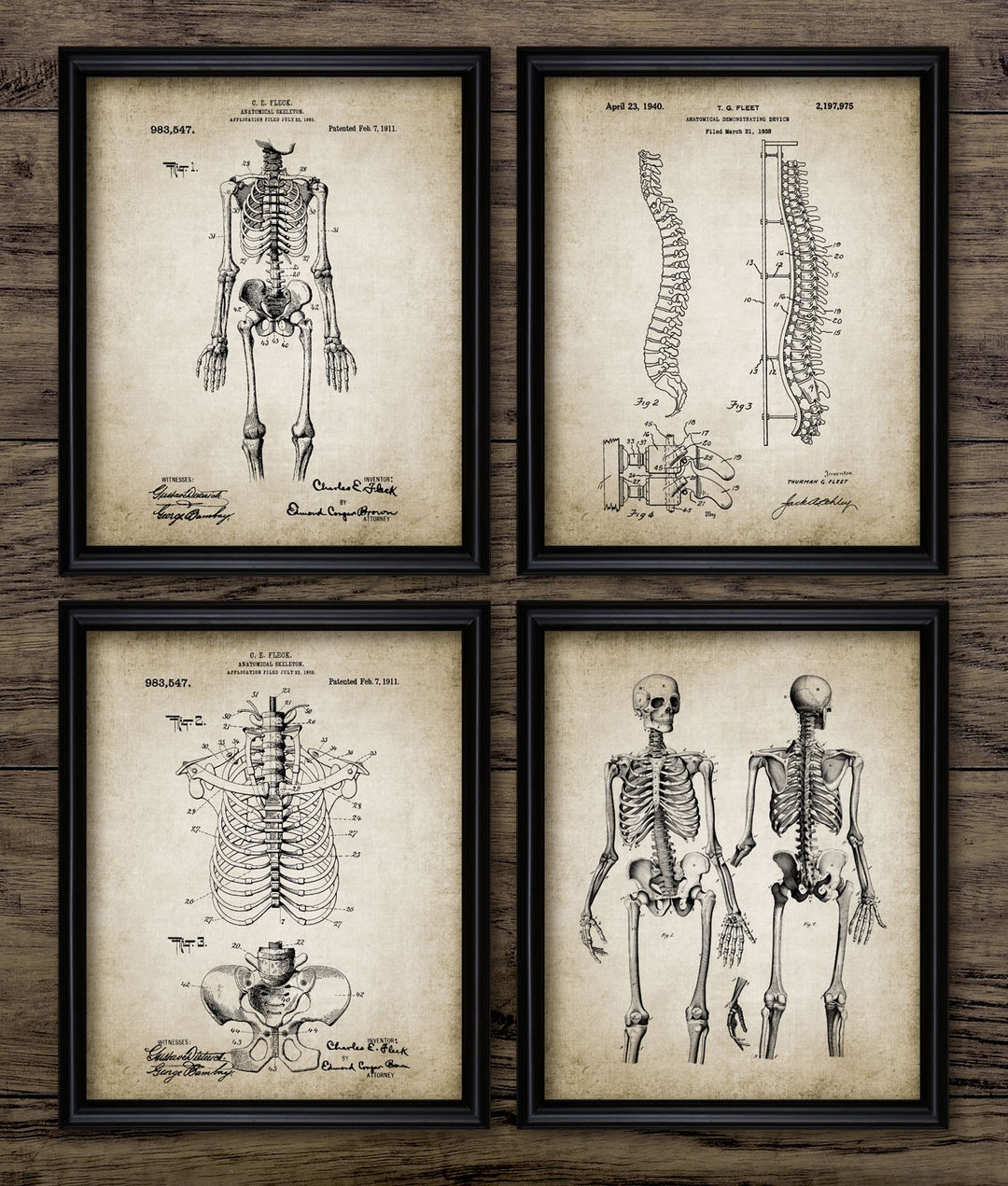 Vintage Human Anatomy Wall Art Set of 4, Printable Human Skeleton ...