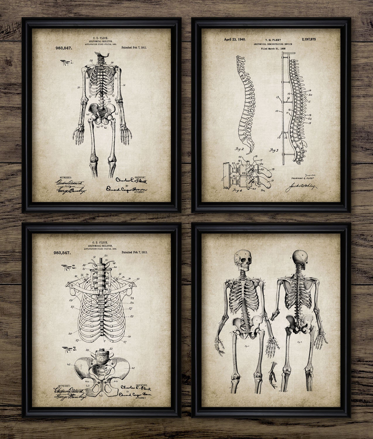 Vintage Human Anatomy Wall Art Set of 4, Printable Human Skeleton ...