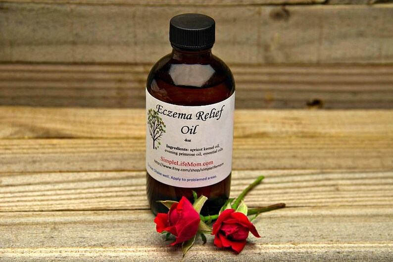 ECZEMA BODY OIL 4oz Sensitive Skin 100%natural Soothes | Etsy