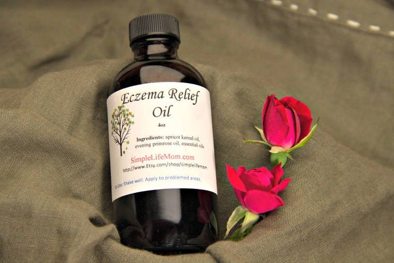 ECZEMA BODY OIL 4oz Sensitive Skin 100natural Soothes Etsy