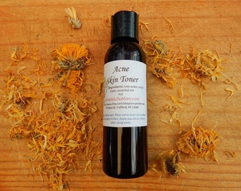 ACNE SKIN TONER - acne facial toner with rose water and aloe, tea tree toner for men, teen acne treatment, natural toner with essential oils