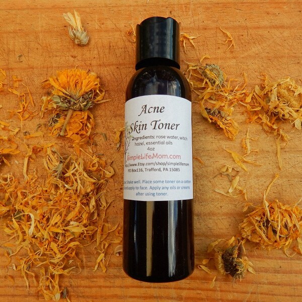 ACNE SKIN TONER - acne facial toner with rose water and aloe, tea tree toner for men, teen acne treatment, natural toner with essential oils