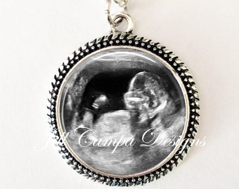 YOUR BABY'S  Sonogram Necklace, Your baby's sonogram on a necklace - Ultrasound Pendant - Pregnancy Gift , New Baby