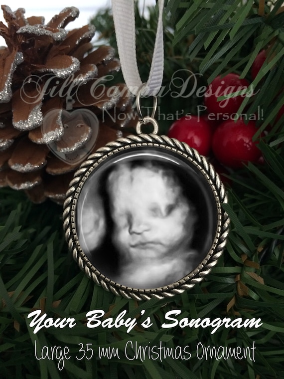 sonogram ornament