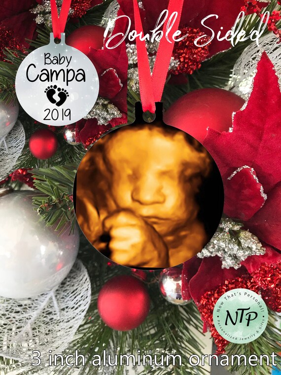 baby ultrasound christmas ornament