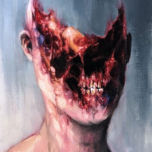 tryck (10x13 cm eller 20x25 cm) hemmorh II