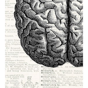 May include: A black and white illustration of a human brain. The image is from an old medical textbook and includes text about the brain and its functions.