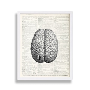 May include: A black and white anatomical illustration of the human brain, printed on a page from an old medical textbook. The text on the page includes the word "Brain".