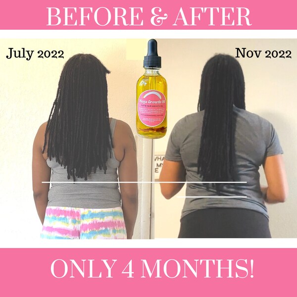 Hair Growth Oil, Hair Serum, Rapid Growth Oil, Natural Hair Oil, Mega Growth Oil, Scalp Healing Oil, Hair Growth Serum (2 Oil Pack)