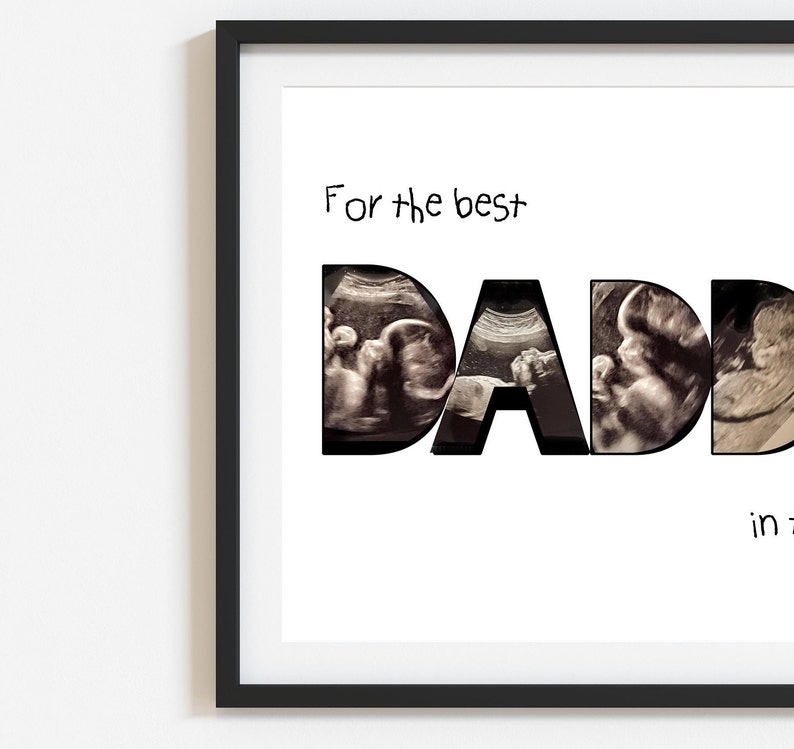 DOWNLOADABLE Baby Scan Keepsake Scan Photo Personalised Baby Etsy