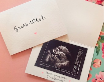 Guess What Pregnancy Announcement Scan Card. You're Going To Be A... Surprise Card
