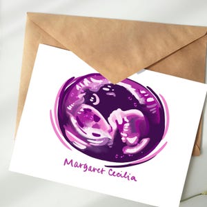 Custom Sonogram Digital Art, Printable, Colorful Ultrasound Art, Digital Download, Baby Shower Thank You Cards, Nursery Art