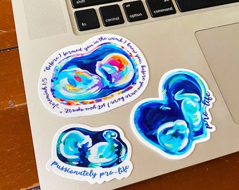 Pro Life Sonogram Stickers