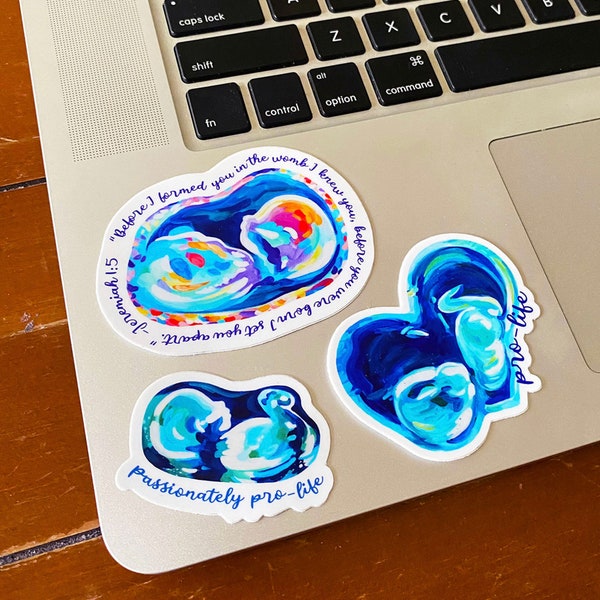 Pro-Life Sonogram Sticker Variety Pack, 5 Beautiful Designs, Colorful Sonogram Art, Based on Original Paintings