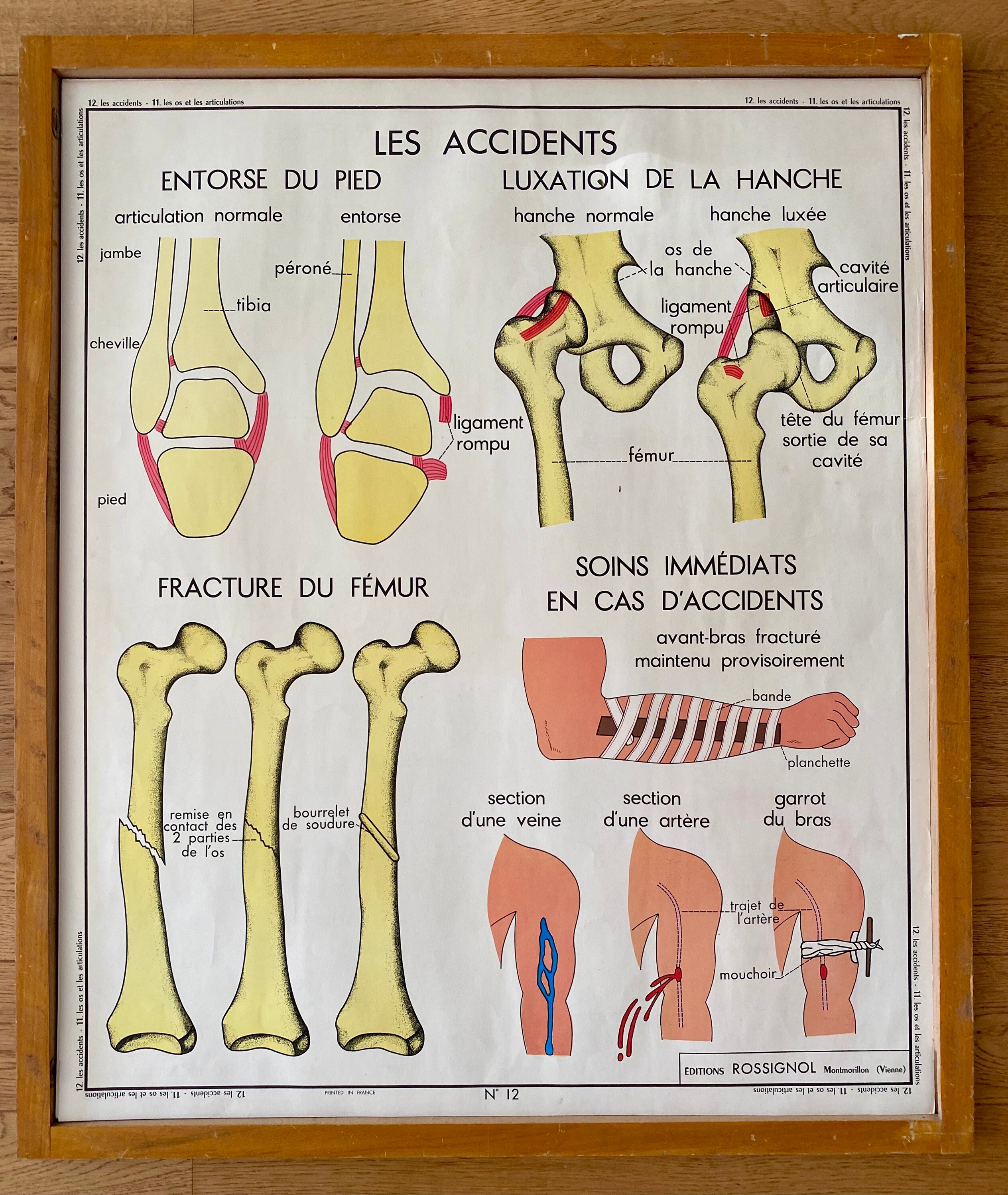 Anciennes Cartes d'anatomie Double Face -Les Os, Les Articulations/Accidents - Affiche Scolaire d'éc