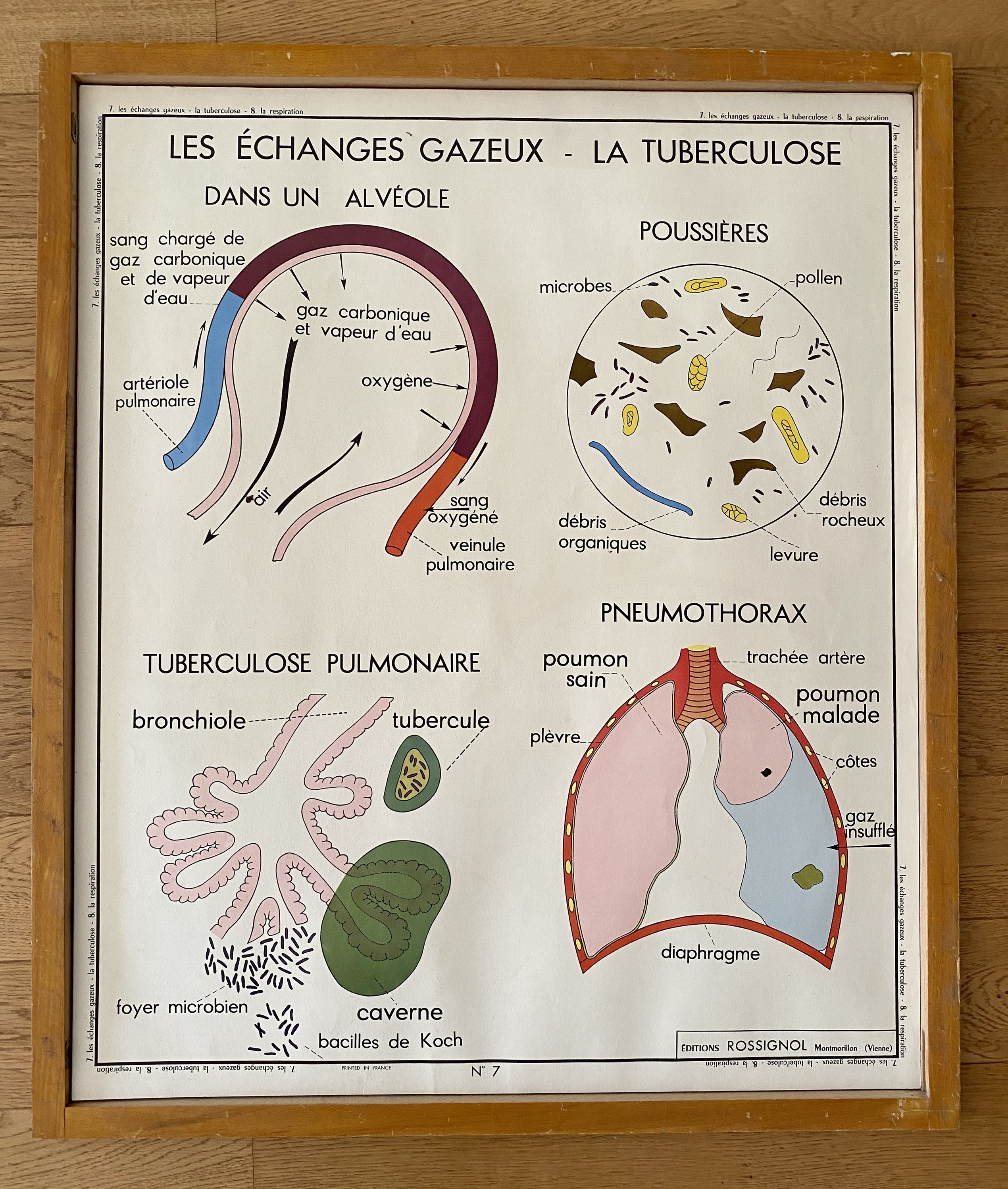 Anciennes Cartes d'anatomie Double Face -Les Échanges Gazeux, La Tuberculose/La Respiration - Affich