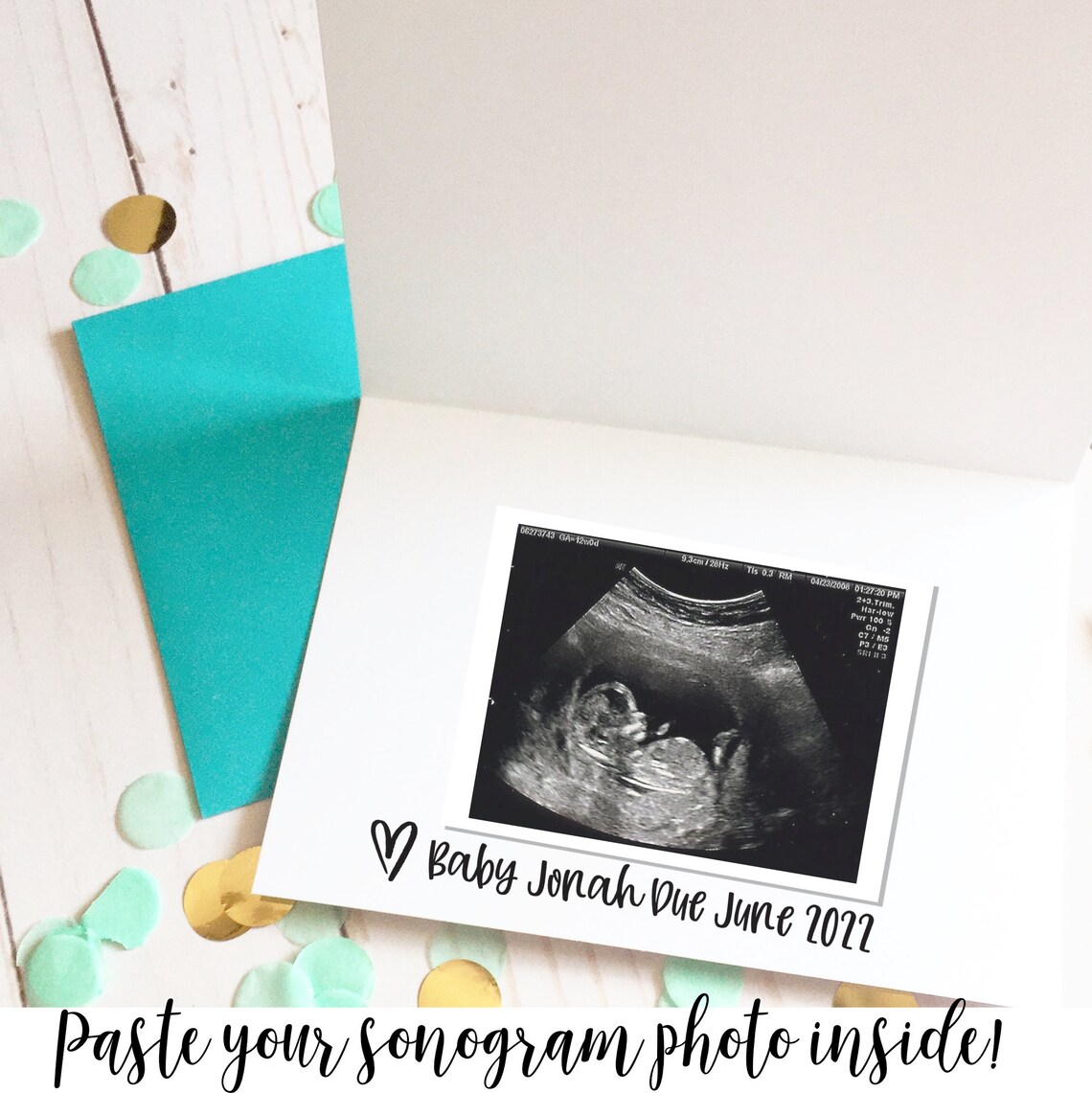 Pregnancy Announcement Card Sonogram Photo Card Ultrasound Etsy