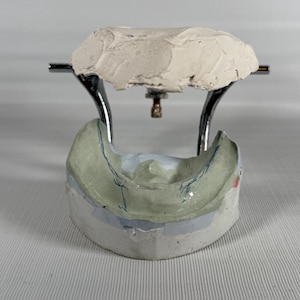 May include: A dental impression model with a light green and blue interior, supported by a metal frame. The model has a white plaster-like substance on top. The base is white and light blue.