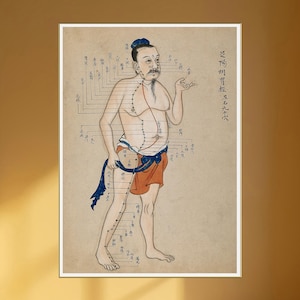 Acupuncture Chrt Body Chart Needle Theraphy Points