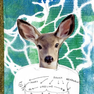 Revista sobre cirugía de pecho (PDF) – Libro de arte ilustrado para personas trans FTM sobre sanación y recuperación