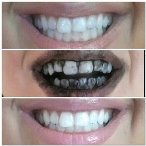 Teeth Whitening Treatment Activated Charcoal & Coconut Oil Paste image 2