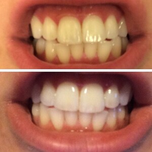 Teeth Whitening Treatment Activated Charcoal & Coconut Oil Paste image 3
