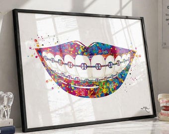 Watercolor Braces Print, Dental Office Art-560