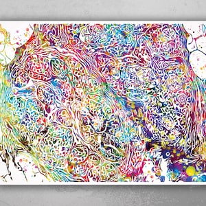 Breast Cancer Histology Watercolor Print Medical Art Breast Cancer Medical Office Decor Oncology Nurse Gift Art Oncologist Doctor Gift-1259