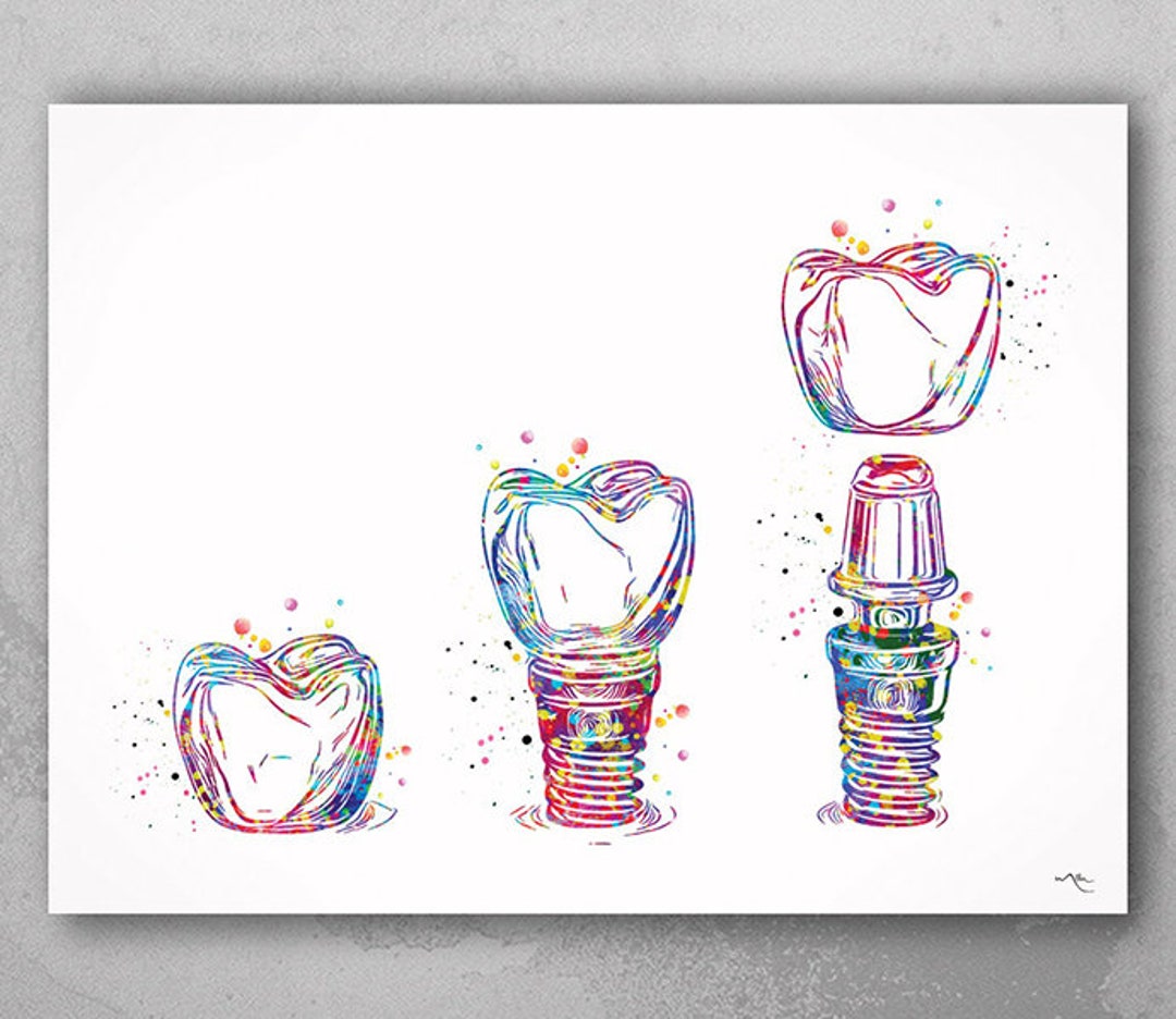 Dental Implant Art Watercolor Print Tooth Anatomical Dental Etsy