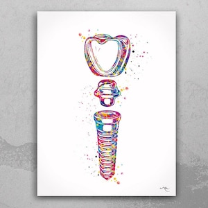 Dental Implant Art Watercolor Print Tooth Anatomical Dental Clinic Decor Dentistry Student Science Graduaiton Dentist Gift Doctor Art-317