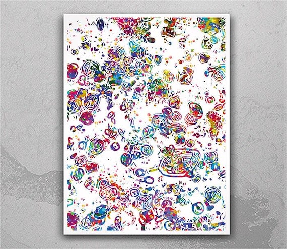 Uric Acid Crystals Watercolor Print, Gout Arthritis Art-2490
