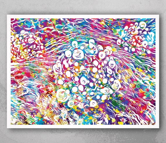 Pancreatic Cancer Histology Watercolor Print, Medical Art-1569