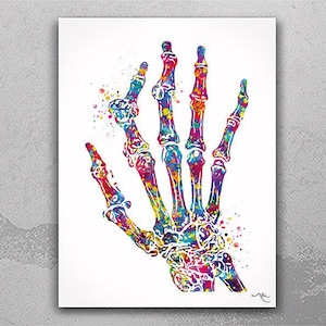 Rheumatoid Arthritis Hand Bone Watercolor Print Carpal Bones  Skeletal Hand Rheumatology Medical Art Orthopedic Art Nurse Clinic Decor-2491