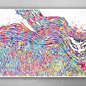 Eczema Pathology Watercolor Print Epidermis Histology Dermatology Skin Cell Clinic Medical Art Dermatologist Office Skin Diseases Art-2322