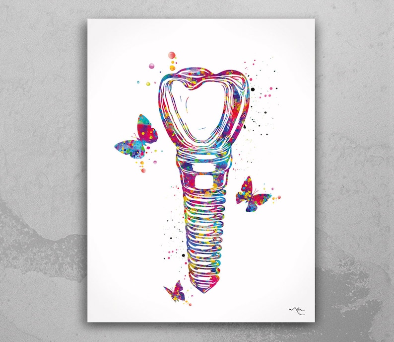 Dental Implant Art Watercolor Print Tooth Anatomical Dental Etsy UK