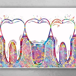Dental Tools Svg, Dentist Digital Files, Tooth Vector, Teeth  Pdf,dwg,dxf,eps, Silhouette, Illustrations, Instant Download, Dentist  Equipment 