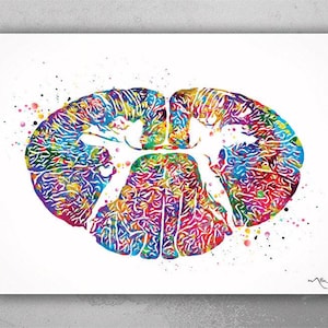 Cervical Spinal Cord Watercolor Print Anatomy Art Medical Art Neurology ...