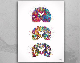 Watercolor Brain Print | Alzheimer's Disease Art, Neurology Decor-1642