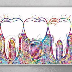 Dental Implant Art Watercolor Print Tooth Anatomical Dental Clinic Decor Dentistry Student Science Graduaiton Dentist Gift Doctor Art-238