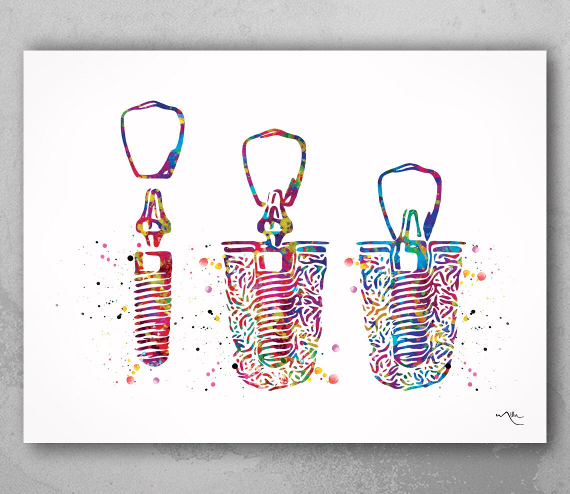 Prints Home & Living Home Décor Dental Implant Watercolor Print Tooth